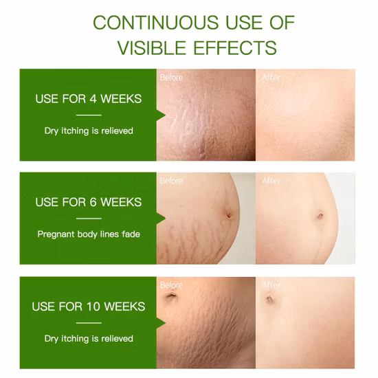 Vendita all'ingrosso di capelli vergini al 100%, viso, corpo, massaggi, smagliature, dispenser per aromaterapia, fragranza di olio essenziale di gelsomino